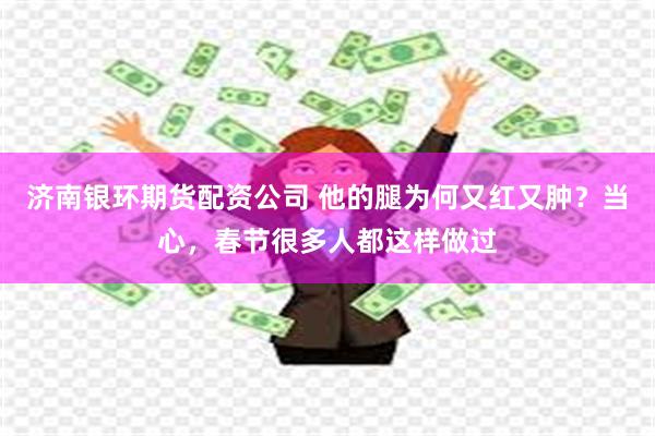 济南银环期货配资公司 他的腿为何又红又肿?当心,春节很多人都这样做过